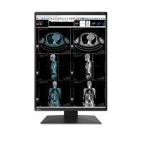 EIZO RadiForce RX370, 54,1 cm (21.3"), 1536 x 2048 Pixel, LCD, 25 ms, Schwarz